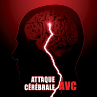 Accidents Vasculaires Cérébral ou AVC