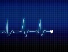 Fréquence cardiaque